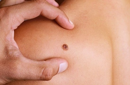 Dermatology Department at HIMS