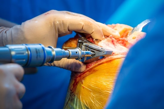 Orthopedics Department at HIMS