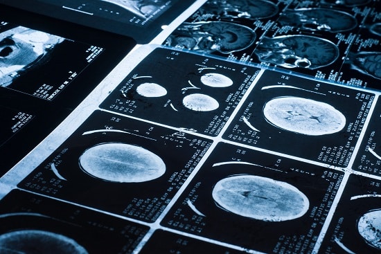 Radio-Diagnosis Department at HIMS