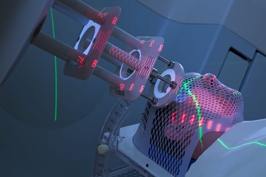 Radiotherapy Department at SRHU